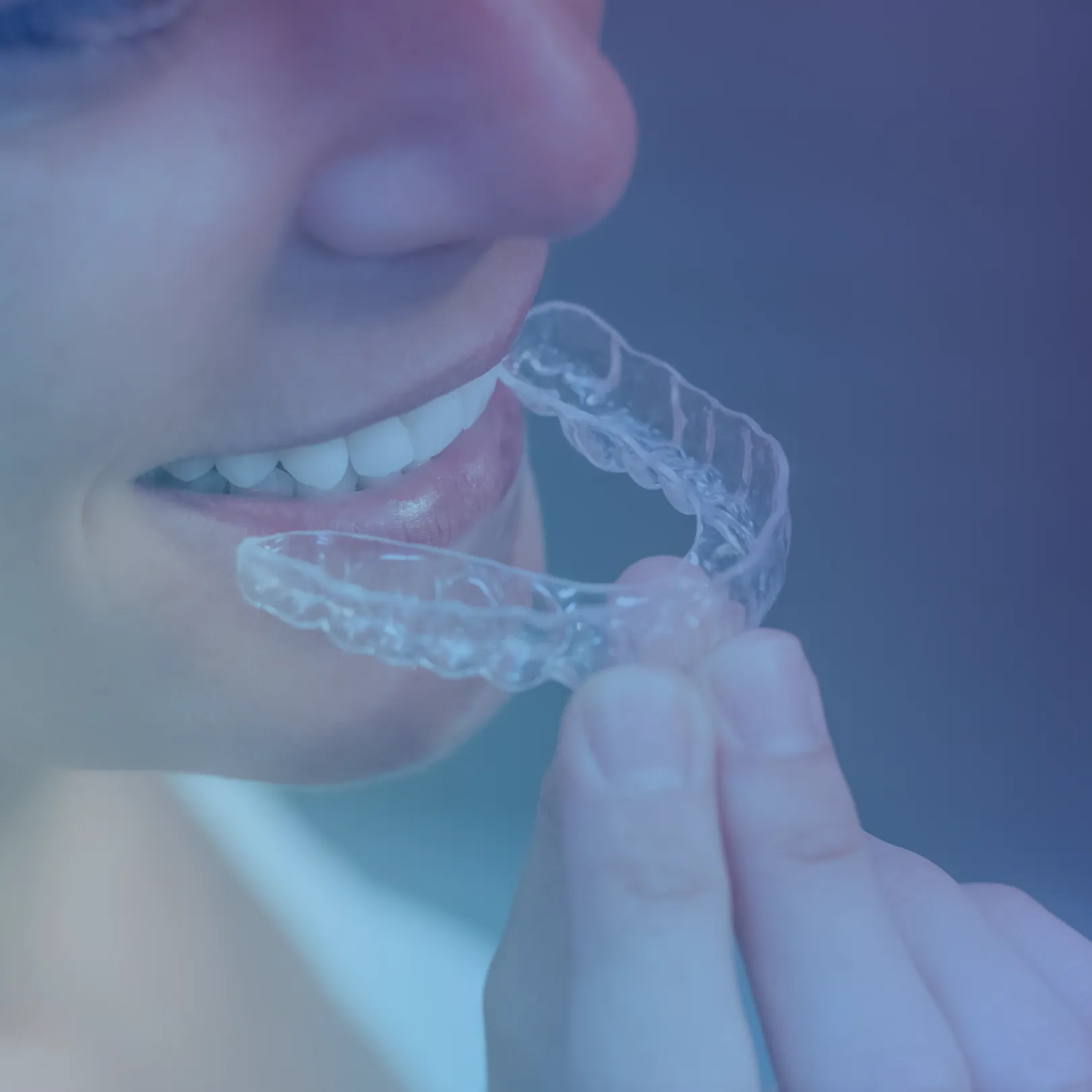 women wearing clear aligner