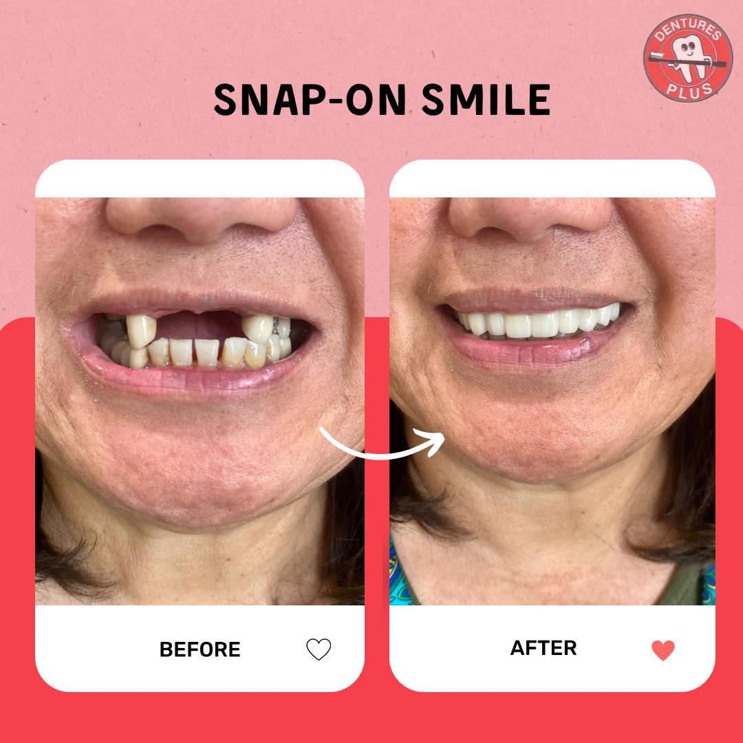 Patient smiling confidently with custom partial dentures from Dentures Plus.