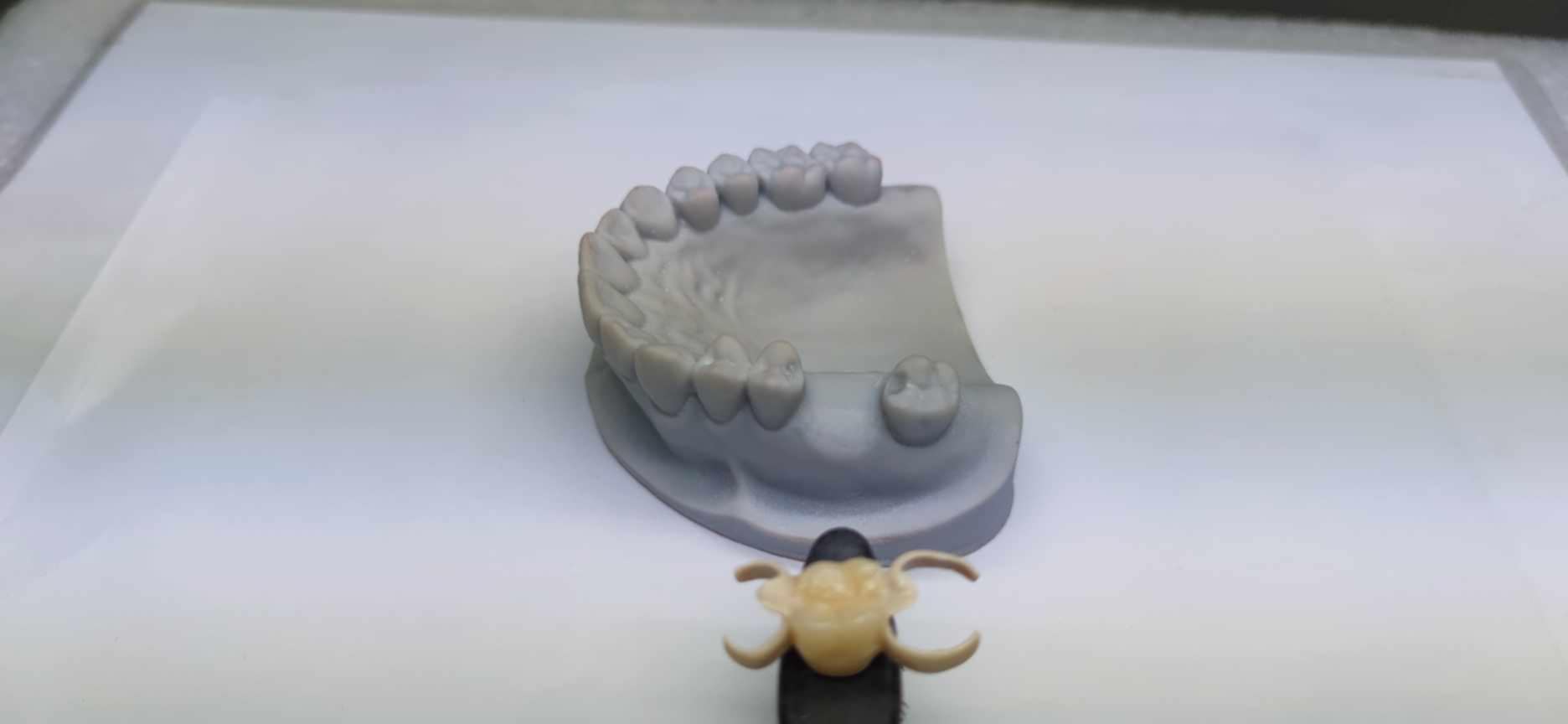 flipper tooth for temporary tooth replacement made by dentures plus