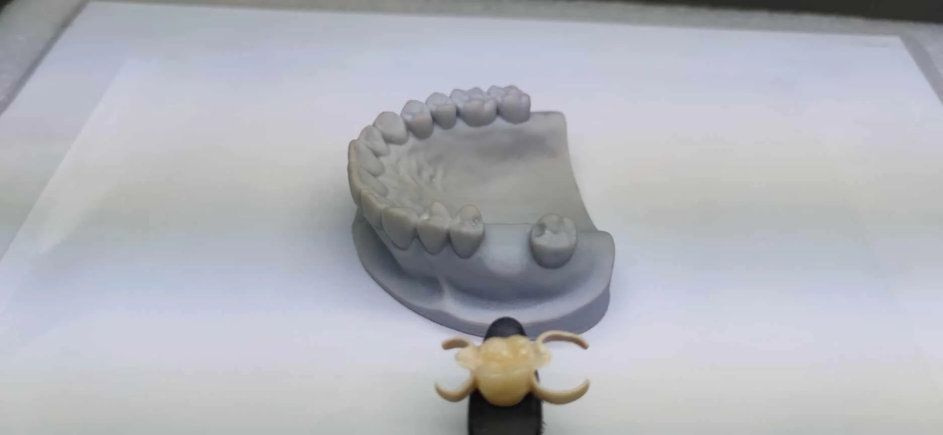 flipper tooth for temporary tooth replacement made by dentures plus