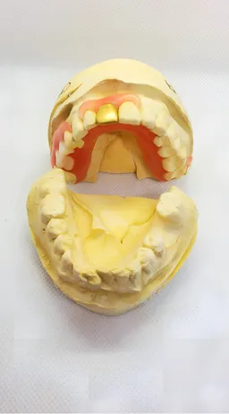 Dentures Plus Dental Lab