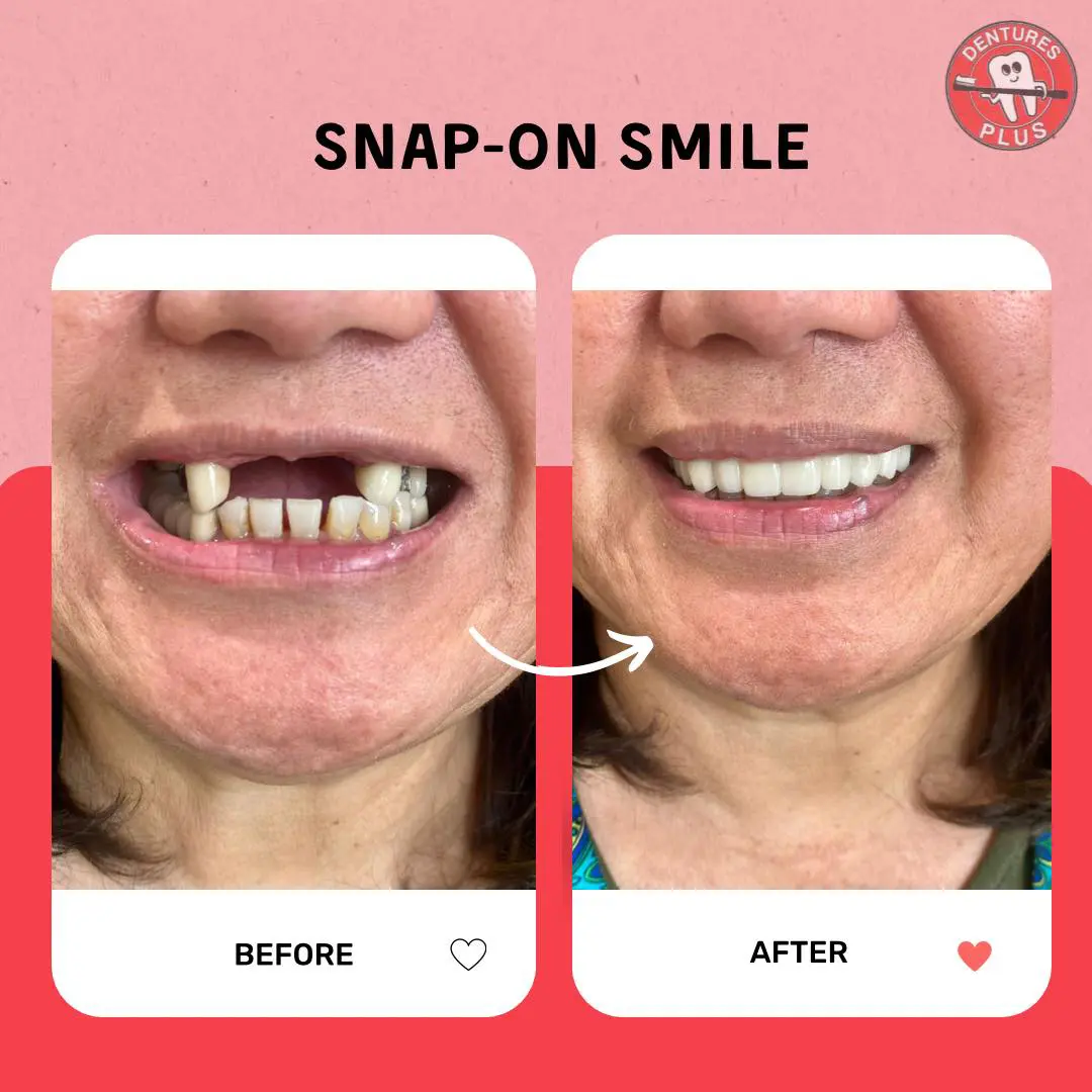 Patient smiling confidently with custom partial dentures from Dentures Plus.
