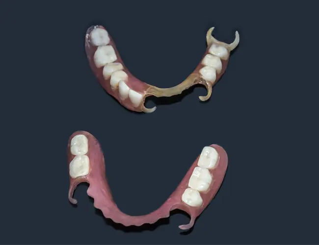 sample product of partial dentures from Dentures Plus