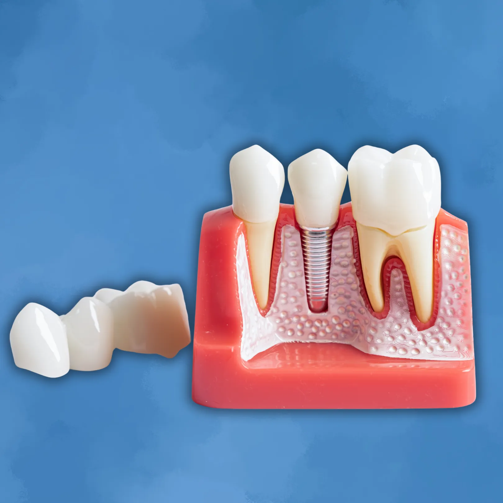 Dentures Plus Dental Lab