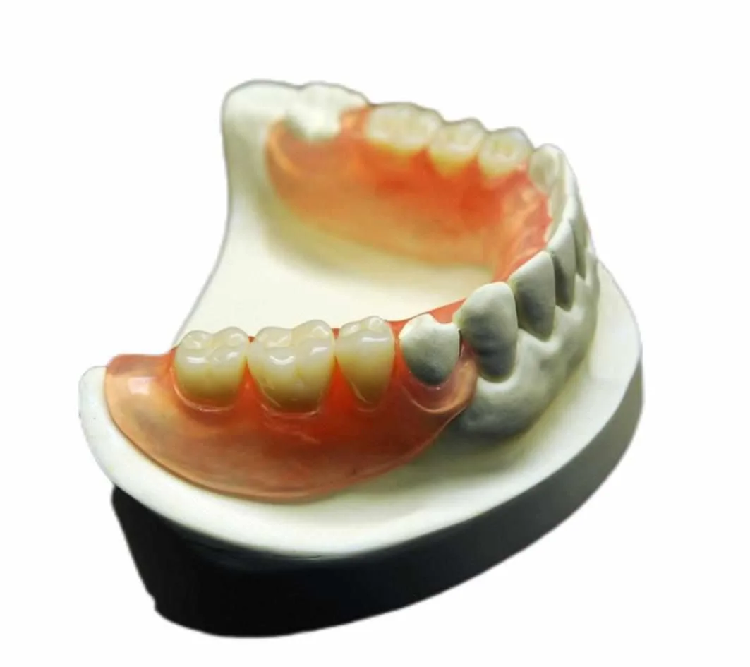 a close-up of our valplast metal free partial dentures made by our team