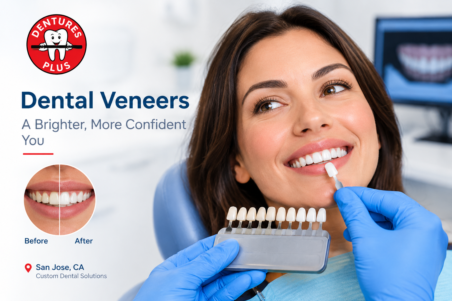 Dental veneers before and after comparison - Dentures Plus San Jose